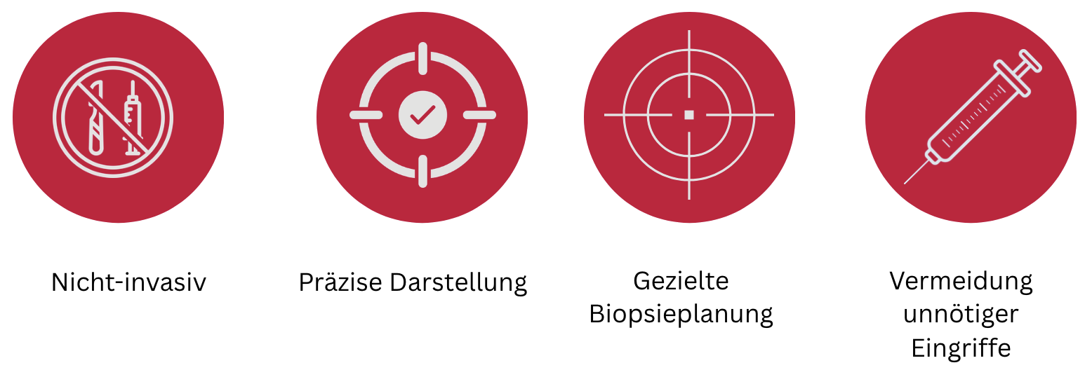 grafik, die Vorteile der Prostata-MRT darstellt: Die Prostata-MRT bietet viele Vorteile gegenüber konventionellen Methoden: Nicht-invasiv: Keine Gewebeentnahme, keine Schmerzen, keine Narkose. Präzise Darstellung: Auffällige Areale werden deutlich sichtbar, oft schon im frühen Stadium. Selbst kleinste Tumorherde können durch das hochsensitive Verfahren detektiert werden Gezielte Biopsieplanung: Falls notwendig, kann eine Biopsie präzise anhand der MRT-Ergebnisse durchgeführt werden. Die MRT Bilder werden in einer MRT Fusionsbiopsie mit dem Ultraschall überlagert, so dass der Tumorherd gezielt biopsiert werden kann. Vermeidung unnötiger Eingriffe: Gutartige und bösartige Befunde können mit hoher Sicherheit erkannt werden, wodurch überflüssige Biopsien vermieden werden können. Kontrollmöglichkeit: Bei Active Surveillance (aktive Überwachung) ist die MRT zur adäquaten Verlaufskontrolle mittlerweile essentiell.