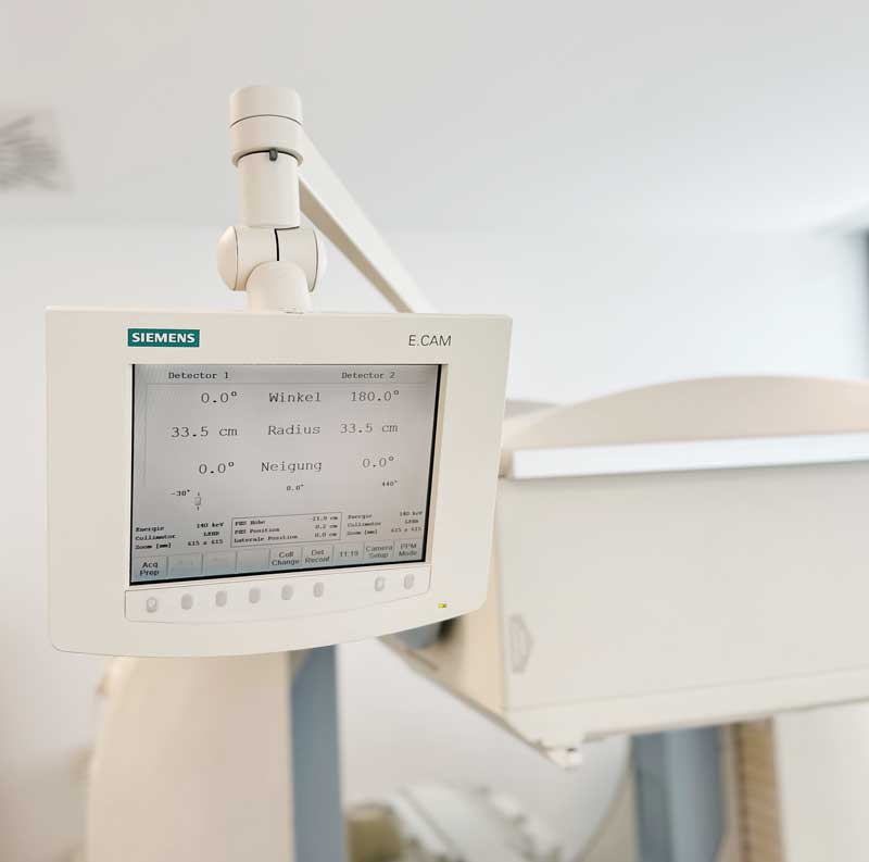 Man sieht einen Bildschirm des RSO Geräts in der Radiologie München Süd West