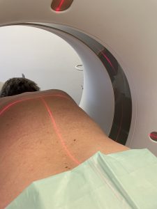 Bandscheibenvorfall: Ursachen, Symptome & Therapie | Radiologie München Süd-West Patient liegt vorbereitet auf dem Bauch im CT. Man sieht die rote Markierung des Gerätes auf seinem Bandscheibenvorfall