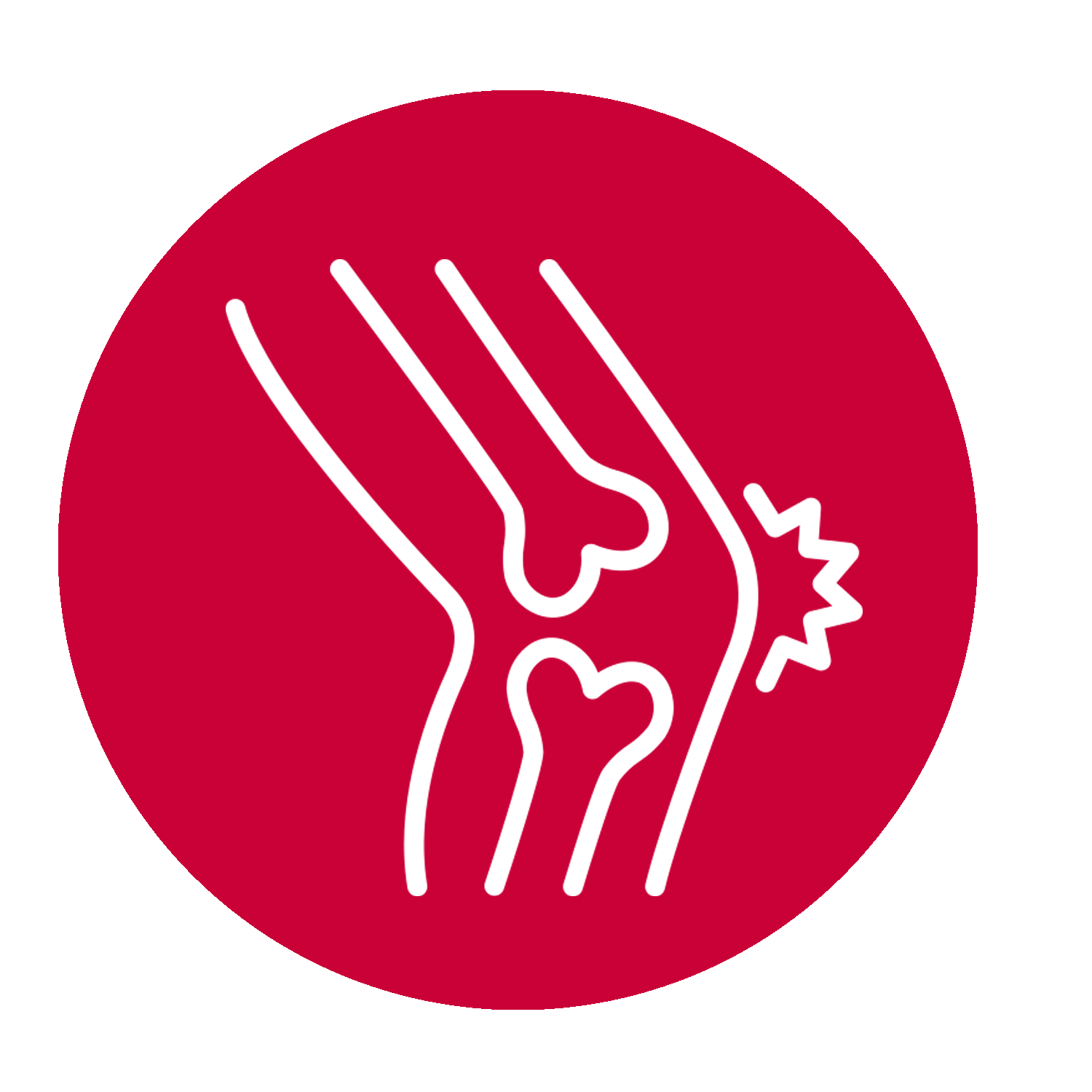 Die Grafik zeigt einen der Gründe an, wann eine Knochendichtemessung empfehlenswert ist: bei Rheuma oder endokrinen Erkrankungen