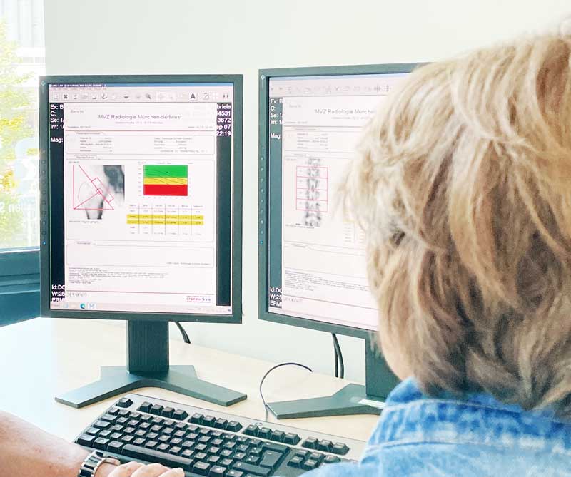 Knochendichtemessung: links im Bild eine Frau von der Seite mit braunen Haaren, blauem Shirt und Brille. Sie sieht auf einen Bildschirm mit Knochendichtemessungs werten in bunt. sie sitzt an einem Schreibtisch aus hellbraunem Holz, vor ihr Radiologie Flyer. Auf dem Schreibtisch ist eine Tastatur, 2 Monitore, eine Computermaus, Telefon.